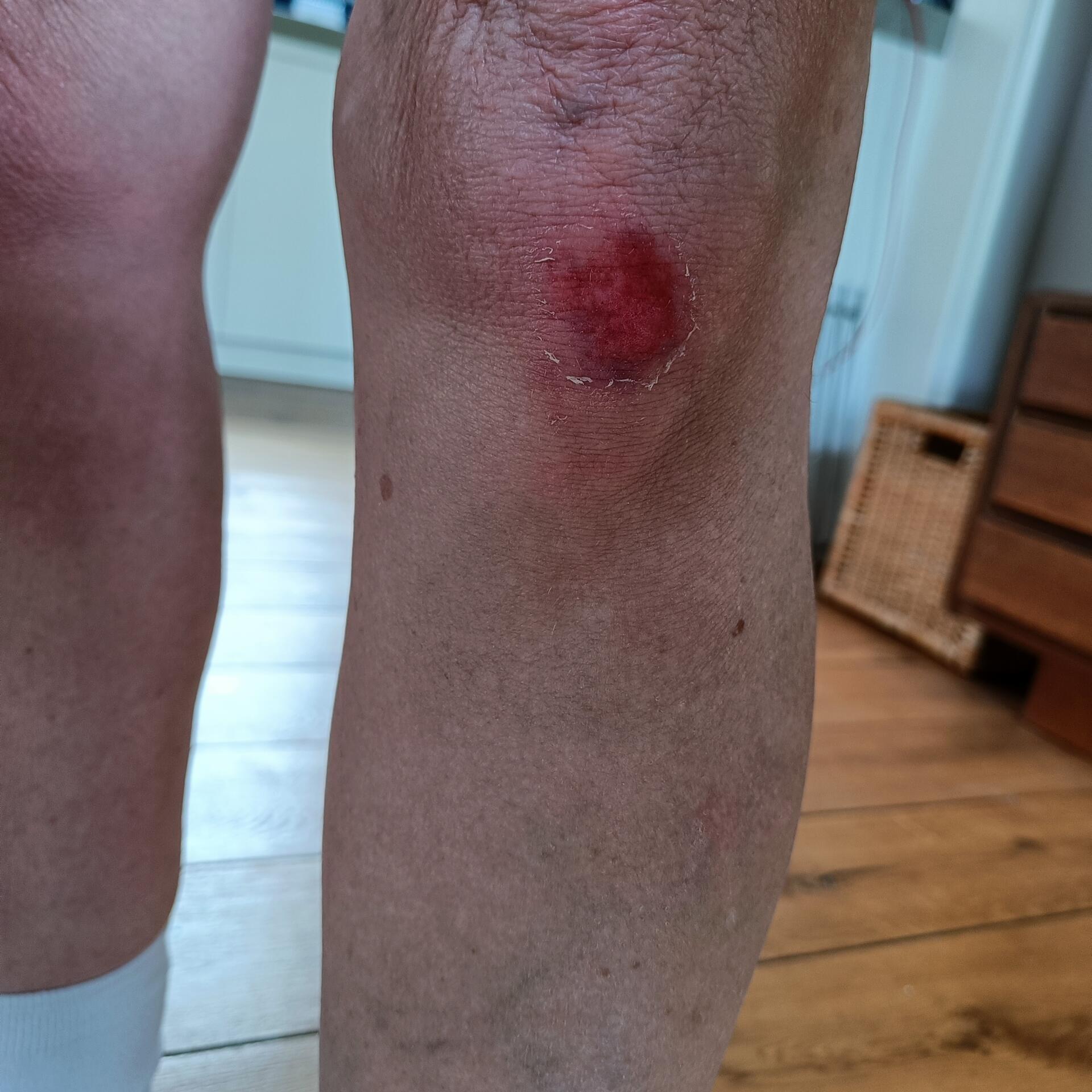 Foto bij melding 5531332 · Wegen, fietspaden, en stoepen